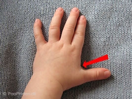Usynlig tommelfinger - placering Thumbnail